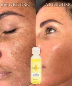 Alternative view of Oilex Natural Spots Whitening Yellow Peeling Oil