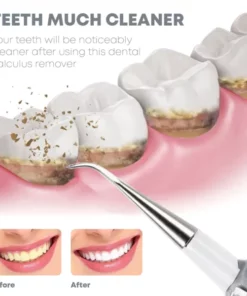 Alternative view of TeethWhitener Ultrasonic Vibration Cleaner
