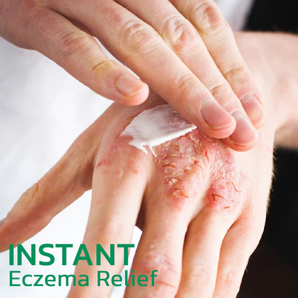 EczmoTherapy Herbal Healing Cream - Image 6