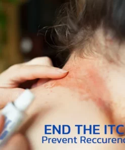 Alternative view of KoTinea Soothing Ointment