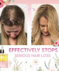 Flora Intense Growth Hair Essential Oil