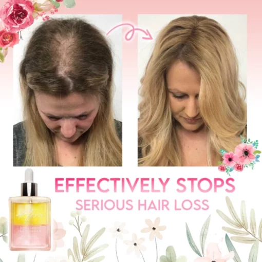 Flora Intense Growth Hair Essential Oil