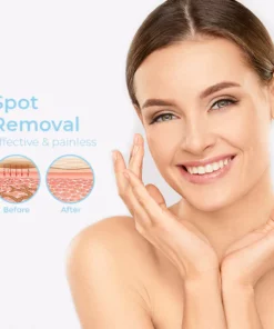 InstaCLEAR Spots Removal Pen