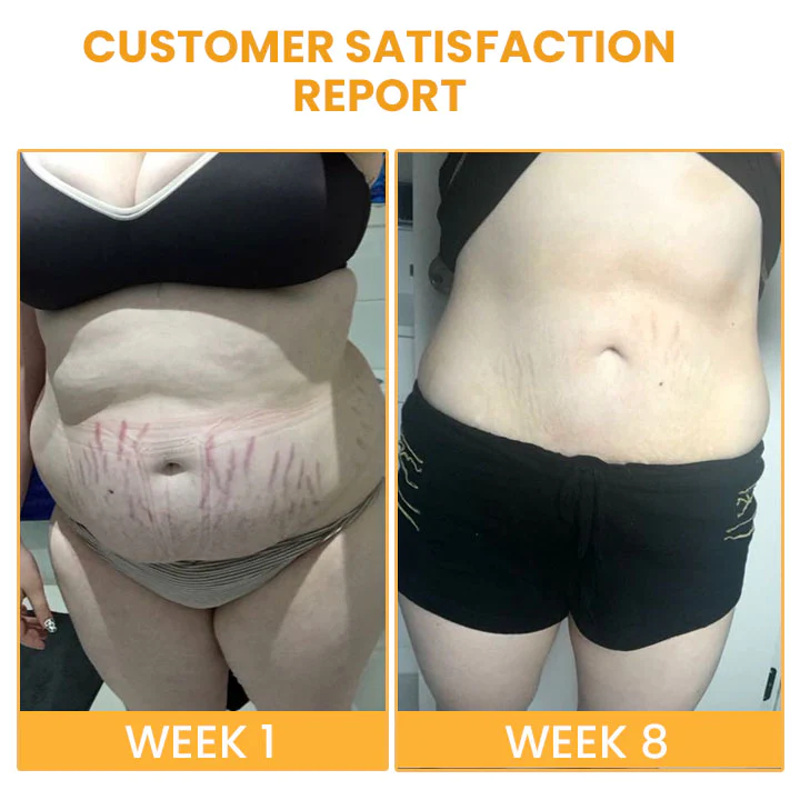 Essura Natural Cellu-Soothe Body Oil - Image 5