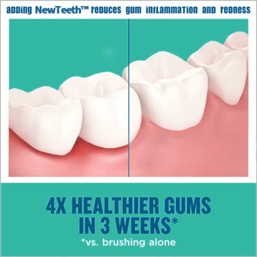NewTeeth Toothpaste Mousse Foam Calculus Removal, Teeth Whitening, Healing Mouth Ulcers, Eliminating Bad Breath, Preventing and Healing Caries, Tooth Regeneration