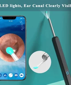 Wi-Fi Visible Wax Elimination Spoon