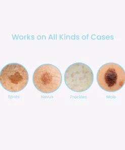 Alternative view of InstaCLEAR Spots Removal Pen