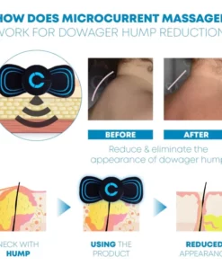 Alternative view of Microcurrent FastRelief Lymphvity NeckMassager