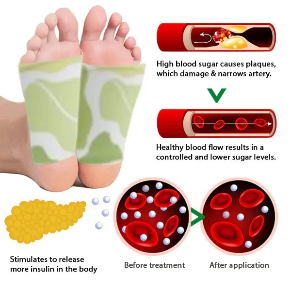 ANLOMARE Blood Sugar and Fat Reducing Foot Pads - Image 3