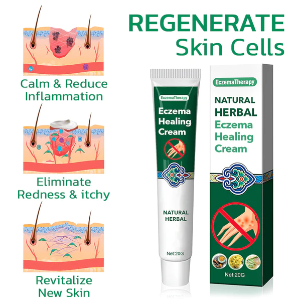 EczmoTherapy Herbal Healing Cream - Image 2