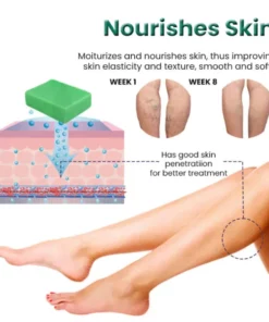 Alternative view of EL VITA Varicose Veins Treatment Soap