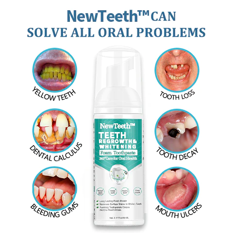 NewTeeth Toothpaste Mousse Foam Calculus Removal, Teeth Whitening, Healing Mouth Ulcers, Eliminating Bad Breath, Preventing and Healing Caries, Tooth Regeneration