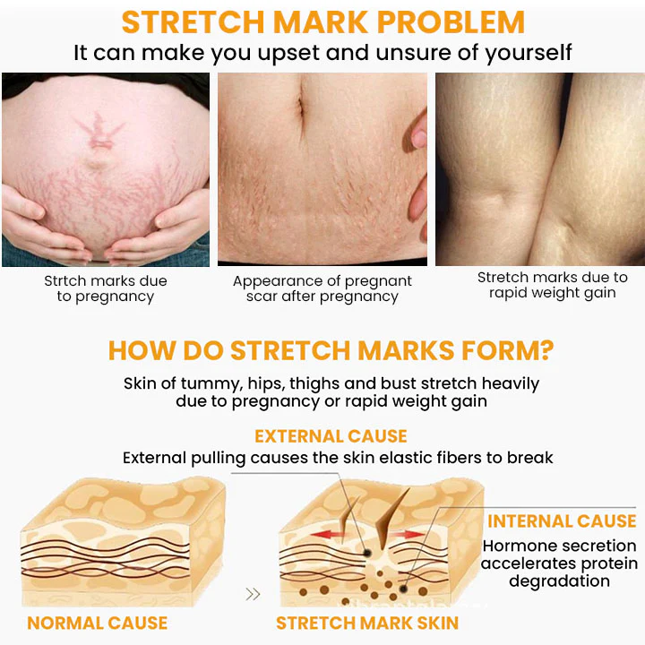 Essura Natural Cellu-Soothe Body Oil - Image 3