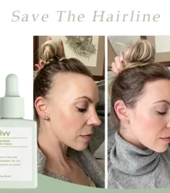 Divv Scalp Serum – Repair & Regrow