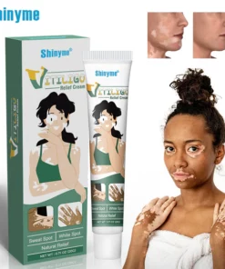 Shinyme Vitiligo Skin Repair Cream