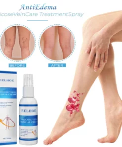 AntiEdema VaricoseVeinCare TreatmentSpray