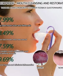 Alternative view of ORAL GUARD Mouth Bleeding-Mouth Ulcers-Oral Disease Treatment Spray