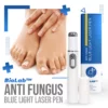 BioLab Anti Fungus Blue Light Laser Pen