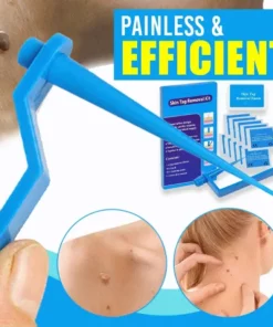 Alternative view of Skin Tag Remover Kit