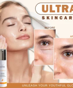 Ultra Skincare Vitamin C Hydrating Anti-aging Serum(50ml, 1.7Fl OZ)