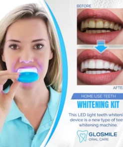 Alternative view of GloSmile Home-Use Teeth Whitening Kit with Led Light