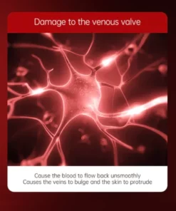 Alternative view of AUQUEST™ Varicose Veins Relief Cream