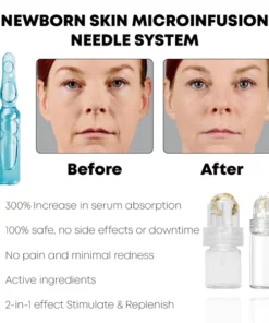 Alternative view of BabySkin MicroInfusion AgelessSystem