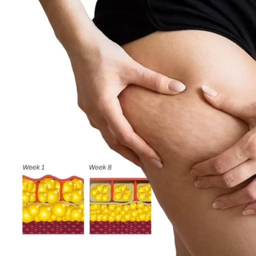 BURNUP AntiCellulite Body Wand - Image 4