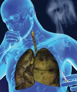 OnNature® Organic Herbs Lung Cleansing&Throat Relief Mouth Spray