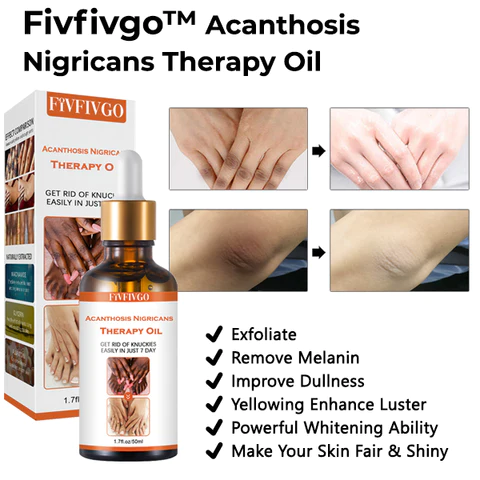 Fivfivgo™ Acanthosis Nigricans Therapy Oil