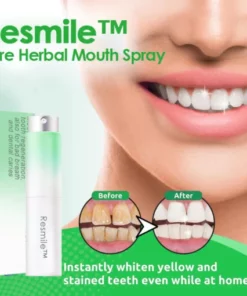 Resmile™ Pure Herbal Mouth Spray (Mouth cleaning and tooth regeneration, also for bad breath and dental caries)