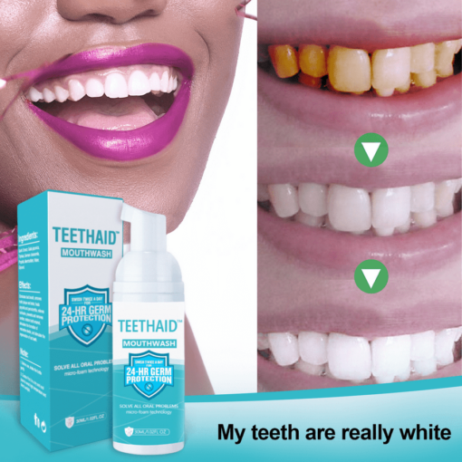 TEETHAID™ MOUTHWASH and CALCULUS REMOVAL