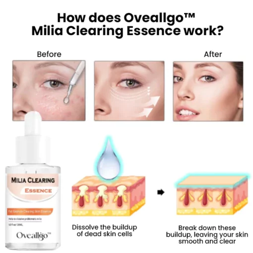 Oveallgo™ Milia Clearing Essence - 8. irudia