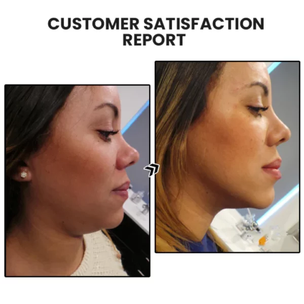 Dorina Ear Acupressure Magnet therapy Detoxi Earrings - Image 9