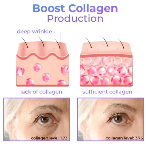 Zaren Collagen Mai Soluble & Nano Platinum Essence Facial Firming Set - Hoto 7