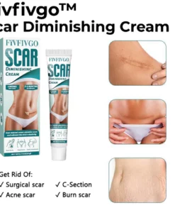 Fivfivgo™ Scar Diminishing Cream
