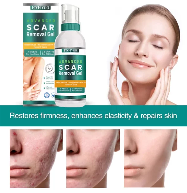 Fivfivgo ScarRemove Advanced Scar Spray