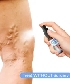 Alternative view of MEDix Varicose Veins Spray