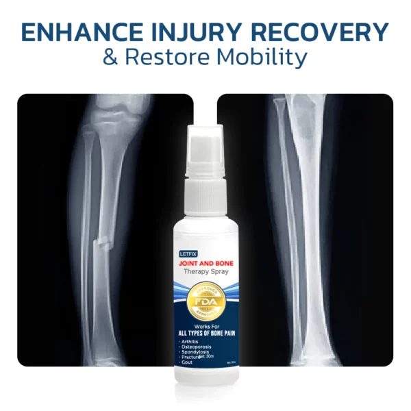 GFOUK Letfix Joint And Bone Therapy Spray