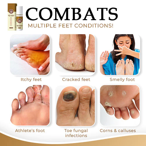 NailCure™ Anti-Fungal Foot Spray - Hoto 5