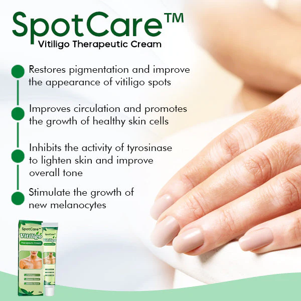 Vitiligo Therapeutic Cream