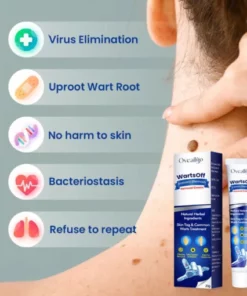Alternative view of Oveallgo™ WartsOff Professional Blemish Removal Cream