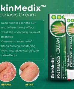 Alternative view of S.Medix™ Psoriasis Cream