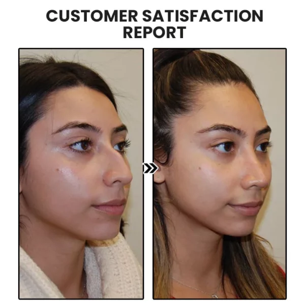 Dorina Ear Acupressure Magnet therapy Detoxi Earrings - Image 7