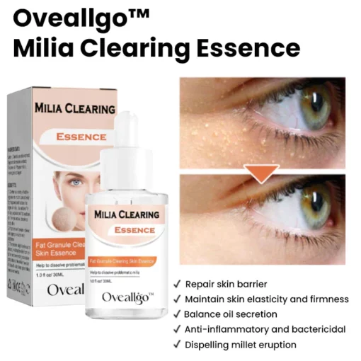 Oveallgo™ Milia Clearing Essence - 6. irudia