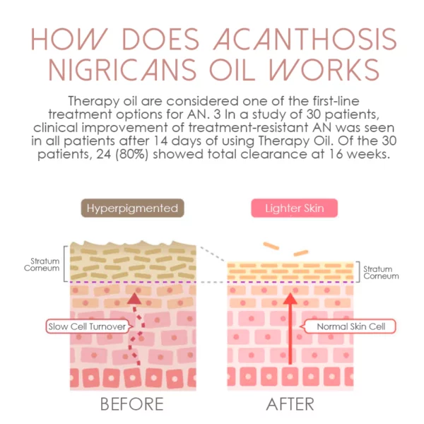ATTDX Lightens AcanthosisNigricans TherapyOil - Image 5