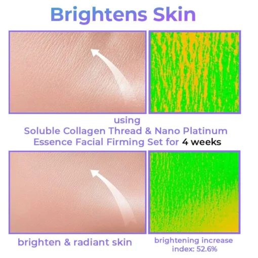 Zaren Collagen Mai Soluble & Nano Platinum Essence Facial Firming Set - Hoto 2