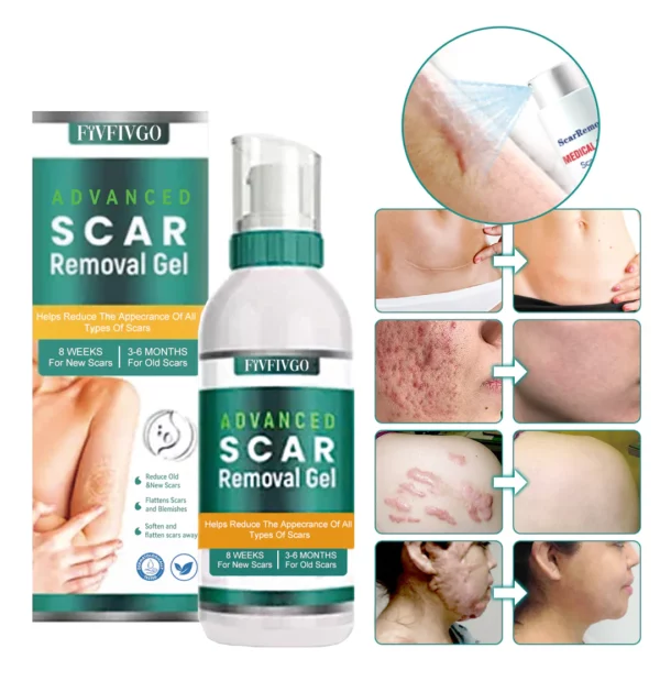 Fivfivgo ScarRemove Advanced Scar Spray