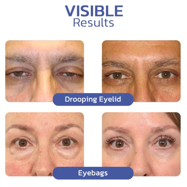 BIGEYES Lifting Eyelid Defining Cream