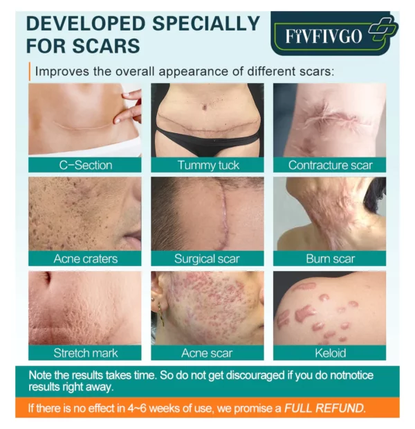 Fivfivgo ScarRemove Advanced Scar Spray